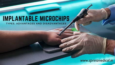 human rfid chip 2016|Microchip implant (human) .